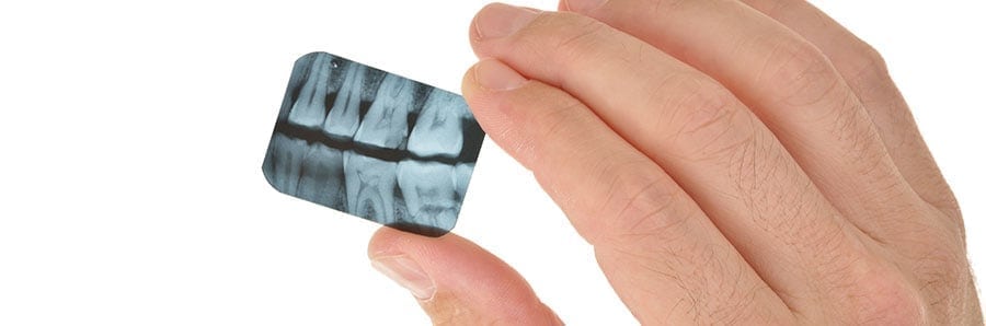 Delta Dental Limiting Bitewings Beginning September 1