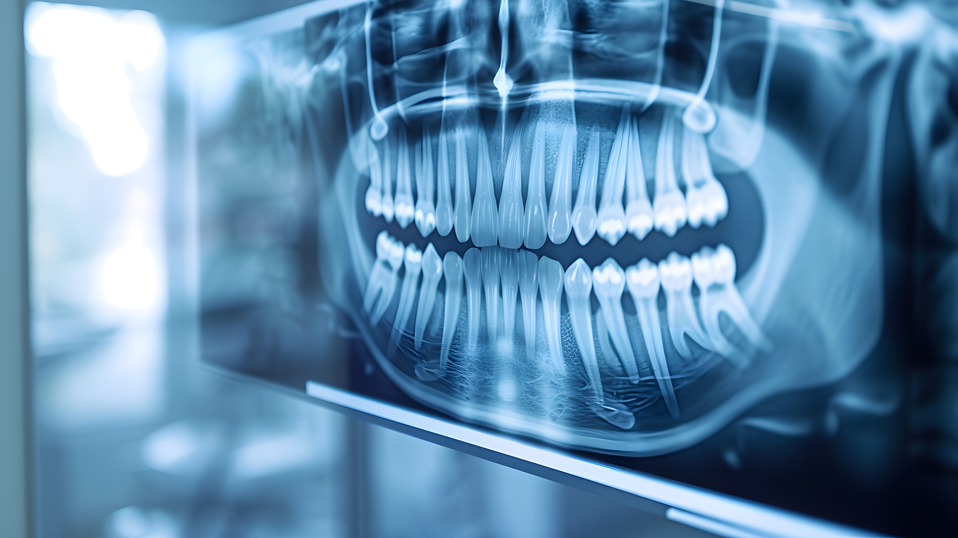 Update on Dental Radiation Shielding